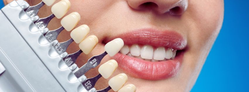 Cosmetic Dentistry in Las Vegas